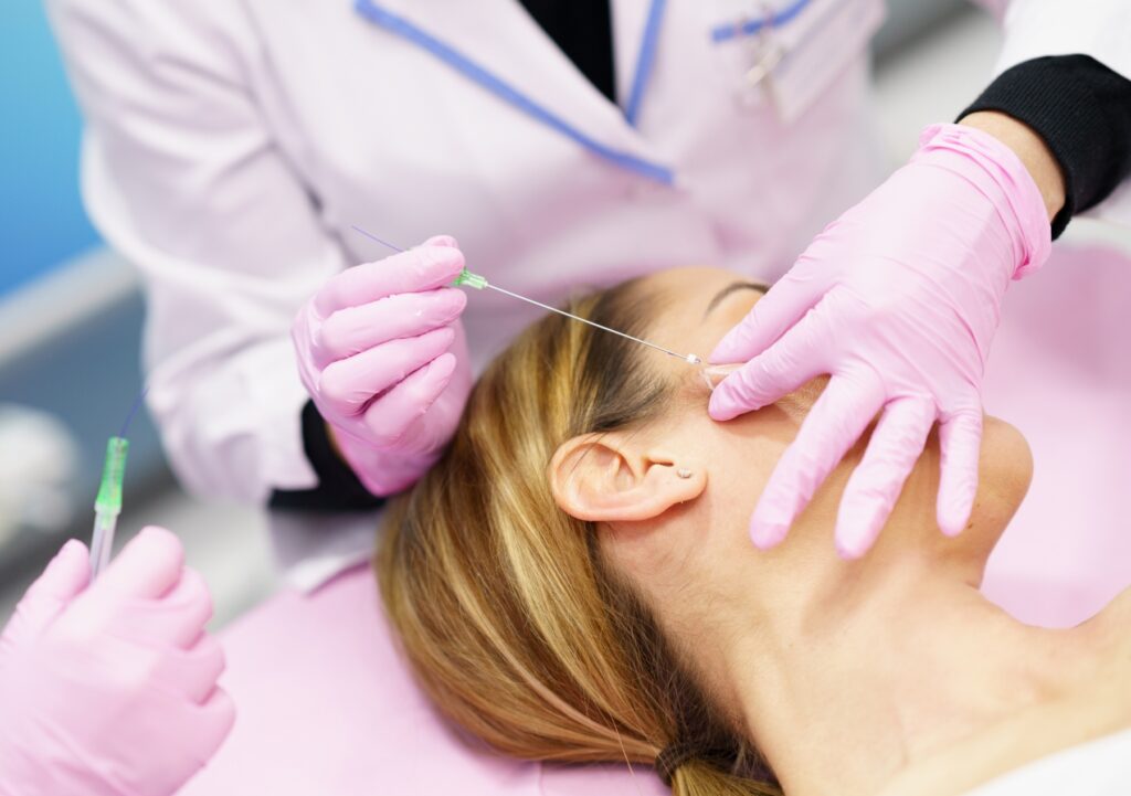 Polydioxanone (PDO) Threads: A Comprehensive Guide